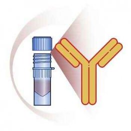 Chicken Anti-Rabbit IgG Antibody (Polyclonal IgG)