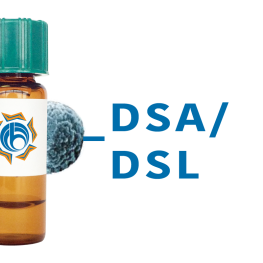 Datura stramonium Lectin (DSA/DSL) - MagneZoom&trade;
