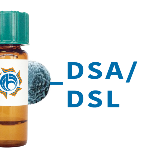 Datura stramonium Lectin (DSA/DSL) - MagneZoom&trade;