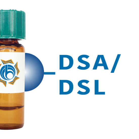 Datura stramonium Lectin (DSA/DSL) - Separopore&reg; 4B