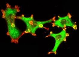 Human Heat Shock Protein 20 (Recombinant)