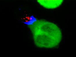 Human Protein Kinase C q (Recombinant)