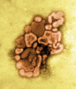 Influenza A Virus H1N1 New Caledonia 20/99 IV 116 (Recombinant)