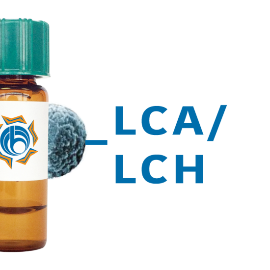 Lens culinaris Lectin (LCA/LCH) - MagneZoom&trade;