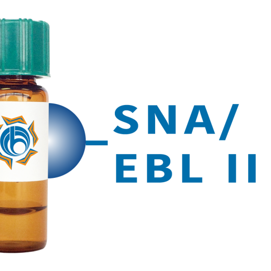Sambucus nigra Lectin (SNA/EBL II) - Separopore&reg; 4B