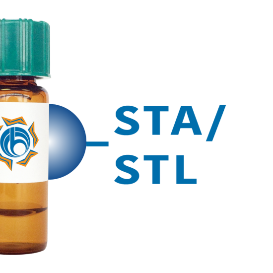 Solanum tuberosum Lectin (STA/STL) - Separopore&reg; 4B