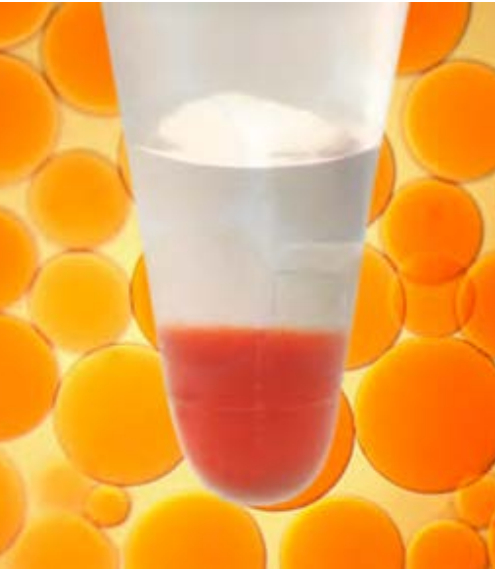 ViewIP™ Separopore® Microbeads